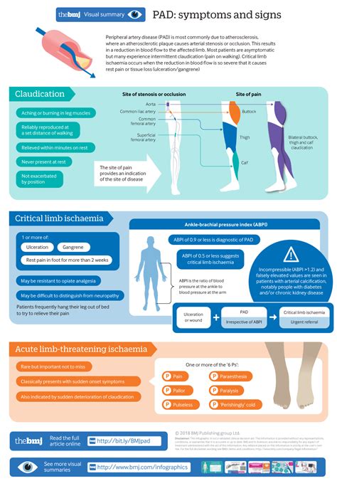 Video: Overview of Peripheral Arterial Disease 